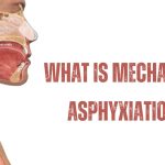 What Is Mechanical Asphyxiation